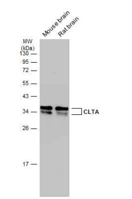 Western Blot: Clathrin light chain Antibody [NBP2-14913]