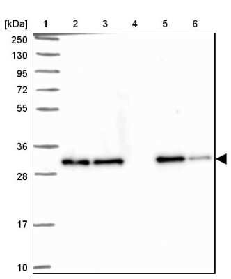 Western Blot: Clathrin light chain Antibody [NBP2-38638]