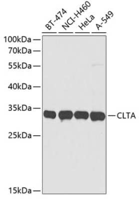 Western Blot: Clathrin light chain AntibodyBSA Free [NBP2-92434]