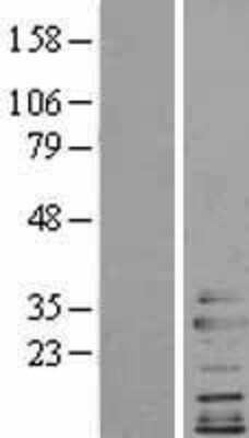 Western Blot: Clathrin light chain Overexpression Lysate [NBL1-09287]