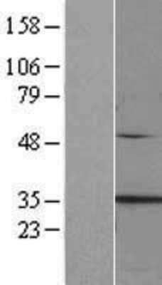 Western Blot: Clathrin light chain Overexpression Lysate [NBP2-10386]