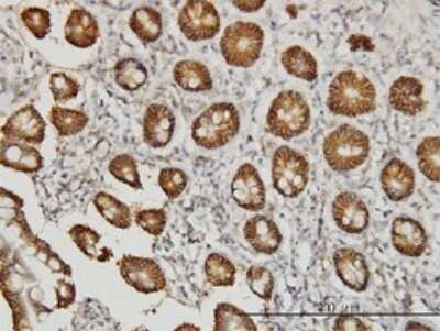 Immunohistochemistry-Paraffin: Claudin-1 Antibody (1C5-D9) [H00009076-M01]