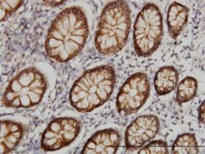 Immunohistochemistry-Paraffin: Claudin-1 Antibody (1C5-D9) [H00009076-M01]