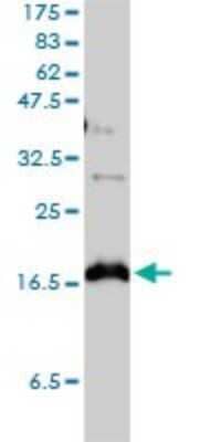 Western Blot: Claudin-1 Antibody (1C5-D9) [H00009076-M01]