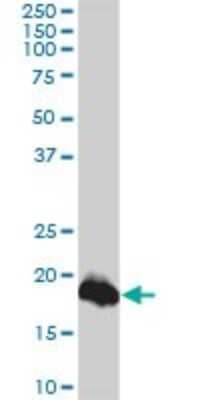 Western Blot: Claudin-1 Antibody (1C5-D9) [H00009076-M01]