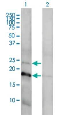 Western Blot: Claudin-1 Antibody (1C5-D9) [H00009076-M01]