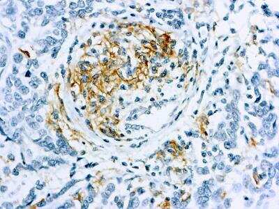 Immunohistochemistry-Paraffin: Claudin-1 Antibody [NB120-15098]