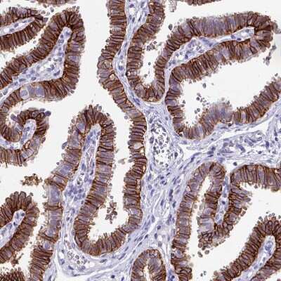 Immunohistochemistry-Paraffin: Claudin-1 Antibody [NBP2-38578]