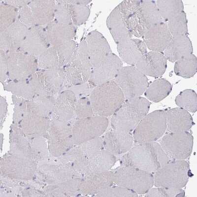Immunohistochemistry-Paraffin: Claudin-1 Antibody [NBP2-38578]