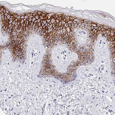 Immunohistochemistry-Paraffin: Claudin-1 Antibody [NBP2-38578]