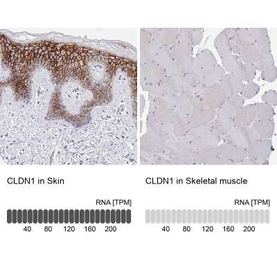 Immunohistochemistry-Paraffin: Claudin-1 Antibody [NBP2-38578]