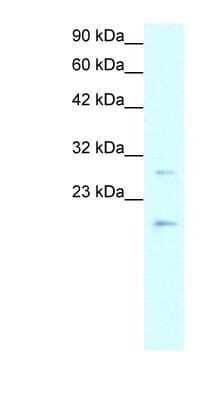 Western Blot: Claudin-1 Antibody [NBP1-59107]