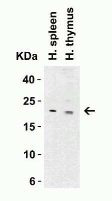 Western Blot: Claudin-1 AntibodyBSA Free [NBP1-77036]