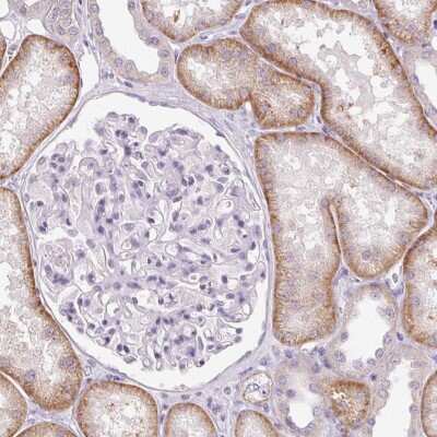 Immunohistochemistry-Paraffin: Claudin 10 Antibody [NBP2-38495]
