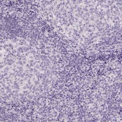 Immunohistochemistry-Paraffin: Claudin 10 Antibody [NBP2-38495]