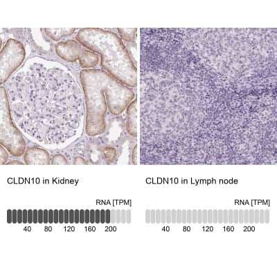 Immunohistochemistry-Paraffin: Claudin 10 Antibody [NBP2-38495]