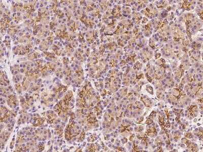 Immunohistochemistry-Paraffin: Claudin 10 Antibody [NBP2-99148]