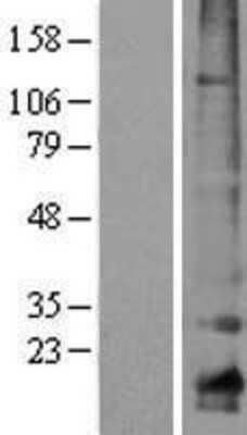 Western Blot: Claudin 10 Overexpression Lysate [NBP2-04323]