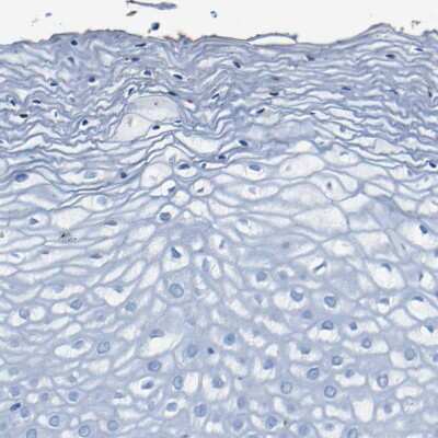 Immunohistochemistry-Paraffin: Claudin-11 Antibody [NBP1-82470]
