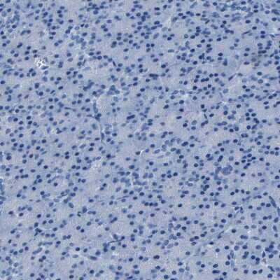 Immunohistochemistry-Paraffin: Claudin-11 Antibody [NBP1-82470]