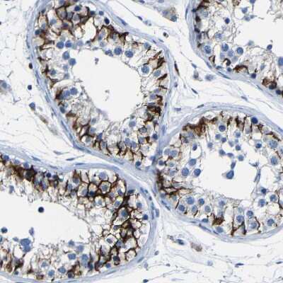 Immunohistochemistry-Paraffin: Claudin-11 Antibody [NBP1-82470]