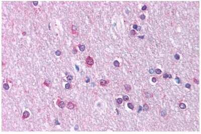 Immunohistochemistry-Paraffin: Claudin-11 Antibody [NBP3-10304]