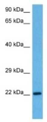 Western Blot: Claudin-11 Antibody [NBP3-10980]