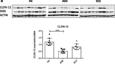 Western Blot: Claudin-12 Antibody [NBP1-87450]