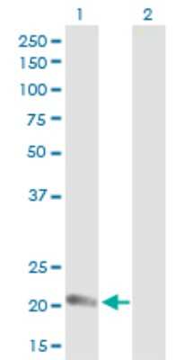 Western Blot: Claudin-14 Antibody [H00023562-D01P]