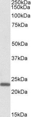 Western Blot: Claudin-14 Antibody [NB100-1070]