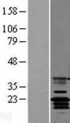 Western Blot: Claudin-14 Overexpression Lysate [NBL1-09239]