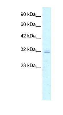 Western Blot: Claudin-15 Antibody [NBP1-59149]