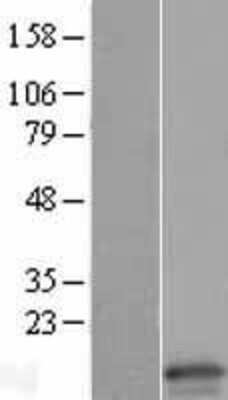 Western Blot: Claudin-15 Overexpression Lysate [NBL1-09240]
