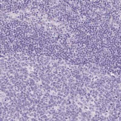 Immunohistochemistry-Paraffin: Claudin-16 Antibody [NBP2-38777]