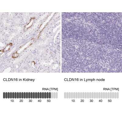 Immunohistochemistry-Paraffin: Claudin-16 Antibody [NBP2-38777]