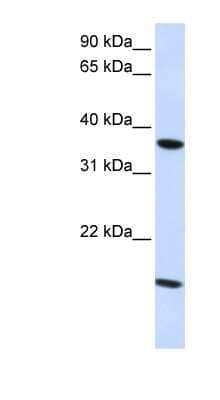 Western Blot: Claudin-16 Antibody [NBP1-59105]