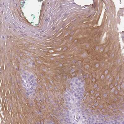 Immunohistochemistry: Claudin-17 Antibody [NBP2-48838]