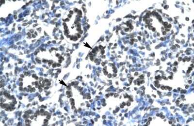 Immunohistochemistry-Paraffin: Claudin-17 Antibody [NBP1-59155]