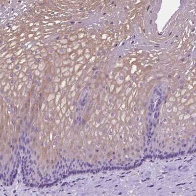 Immunohistochemistry-Paraffin: Claudin-17 Antibody [NBP2-48838]
