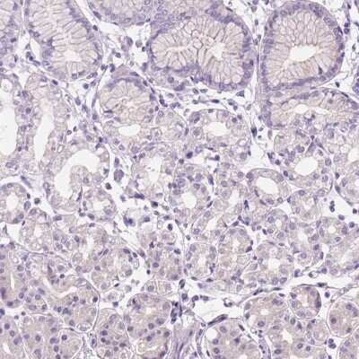 Immunohistochemistry-Paraffin: Claudin-17 Antibody [NBP2-48838]