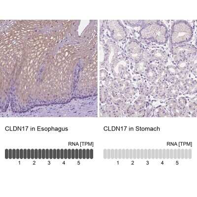 Immunohistochemistry-Paraffin: Claudin-17 Antibody [NBP2-48838]