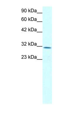 Western Blot: Claudin-17 Antibody [NBP1-59155]