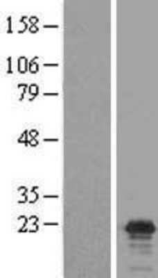 Western Blot: Claudin-17 Overexpression Lysate [NBL1-09242]