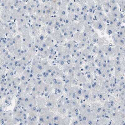 Immunohistochemistry-Paraffin: Claudin-18 Antibody [NBP2-32002]