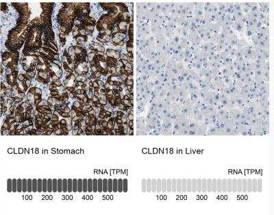 Immunohistochemistry-Paraffin: Claudin-18 Antibody [NBP2-32002]