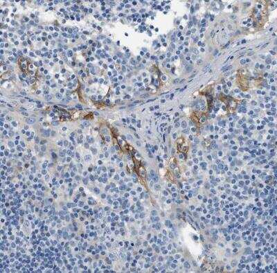 Immunohistochemistry-Paraffin: Claudin-18 Antibody [NBP2-32002]