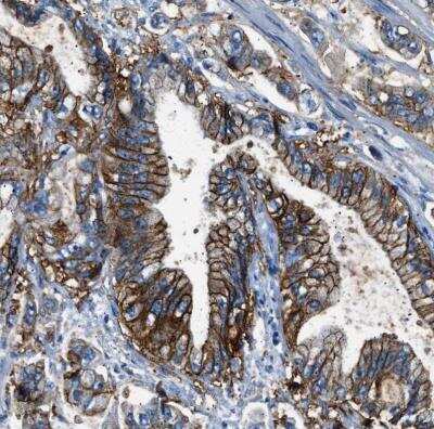Immunohistochemistry-Paraffin: Claudin-18 Antibody [NBP2-32002]