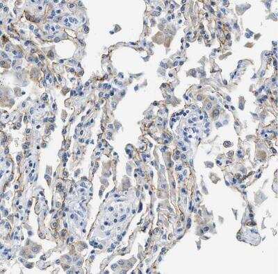 Immunohistochemistry-Paraffin: Claudin-18 Antibody [NBP2-32002]
