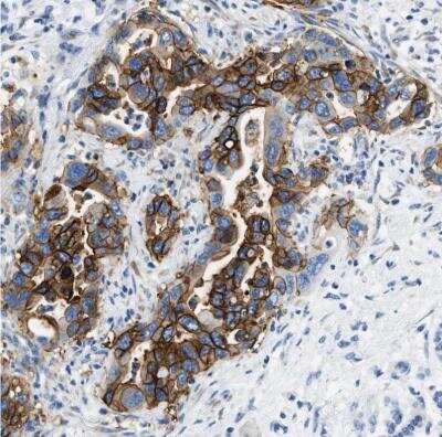 Immunohistochemistry-Paraffin: Claudin-18 Antibody [NBP2-32002]