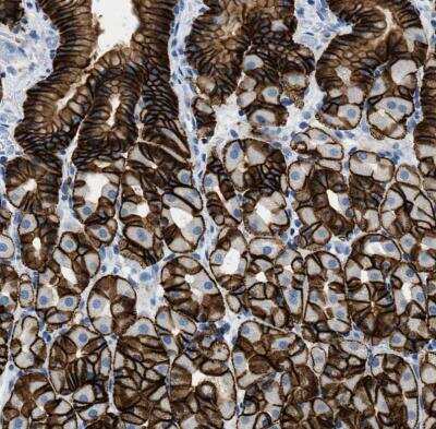 Immunohistochemistry-Paraffin: Claudin-18 Antibody [NBP2-32002]